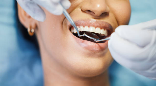 Best Emergency Dental Care for Broken or Chipped Teeth in North Falmouth, MA