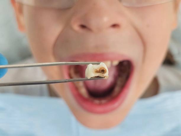 Best Emergency Gum Treatment in North Falmouth, MA